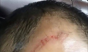 河北一景区观光魔毯疑失控致游客被甩出，涉事景区改造升级重新开园才3天